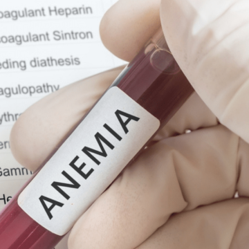 Anemia falciforme, il 55% dei pazienti si cura a casa trascurando i rischi