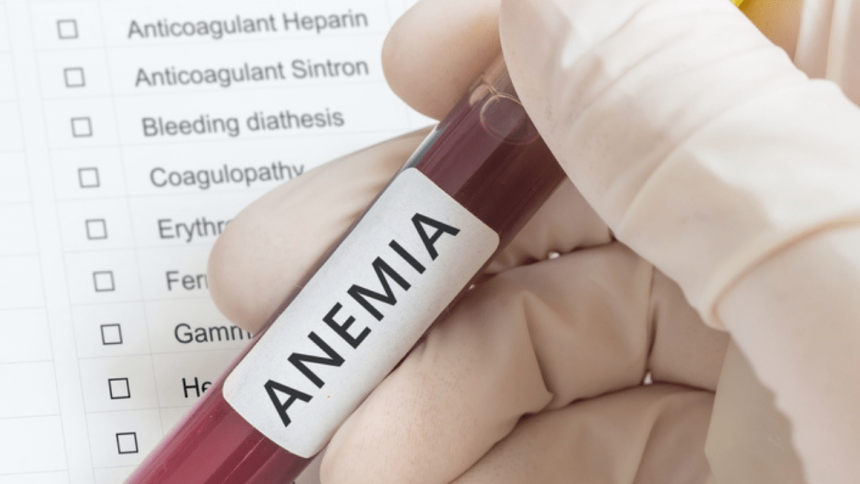 Anemia falciforme, il 55% dei pazienti si cura a casa trascurando i rischi